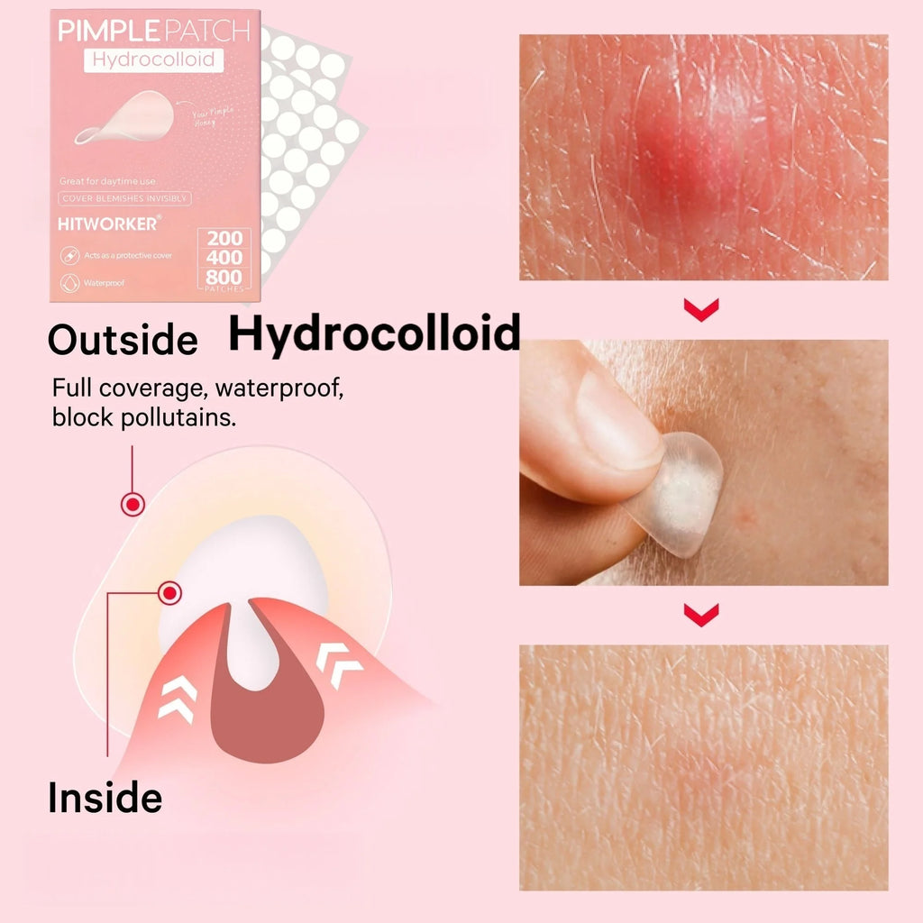 200/400/800 Pieces HITWORKER Hydrocolloid Acne Patches - Invisible, High-Quality Pimple Stickers with Salicylic Acid & Tea Tree